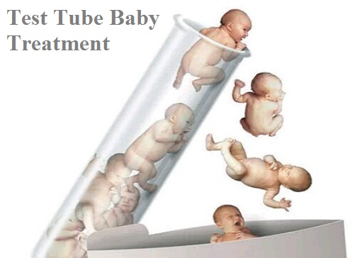 Essay on Test Tube Baby